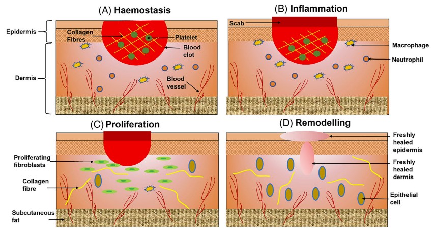 Illustrative diagram of skin wound healing process.