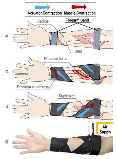 The design and mechanism of the wearable device are shown.