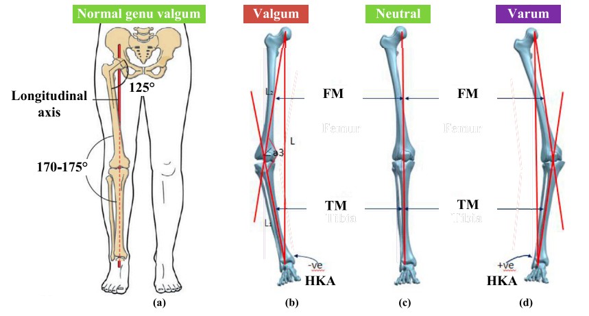 Force Line of the Human Lower Limb.