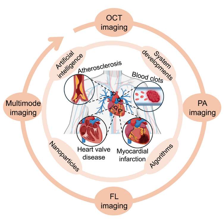 Fig.1 Cardiovascular disease and some common test methods.
