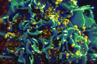 Microscopic view of blue and green curved structures with yellow particles.