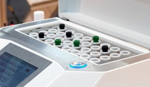 Urine Protein/Creatinine Ratio - Alta DiagnoTech