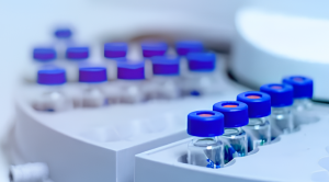 Urine Protein/Creatinine Ratio - Alta DiagnoTech