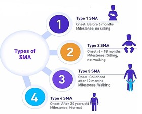 Common types of spinal muscular atrophy.